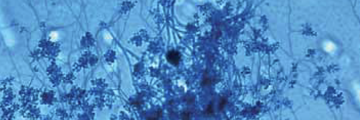 Trichoderma 1 Trichoderma 1