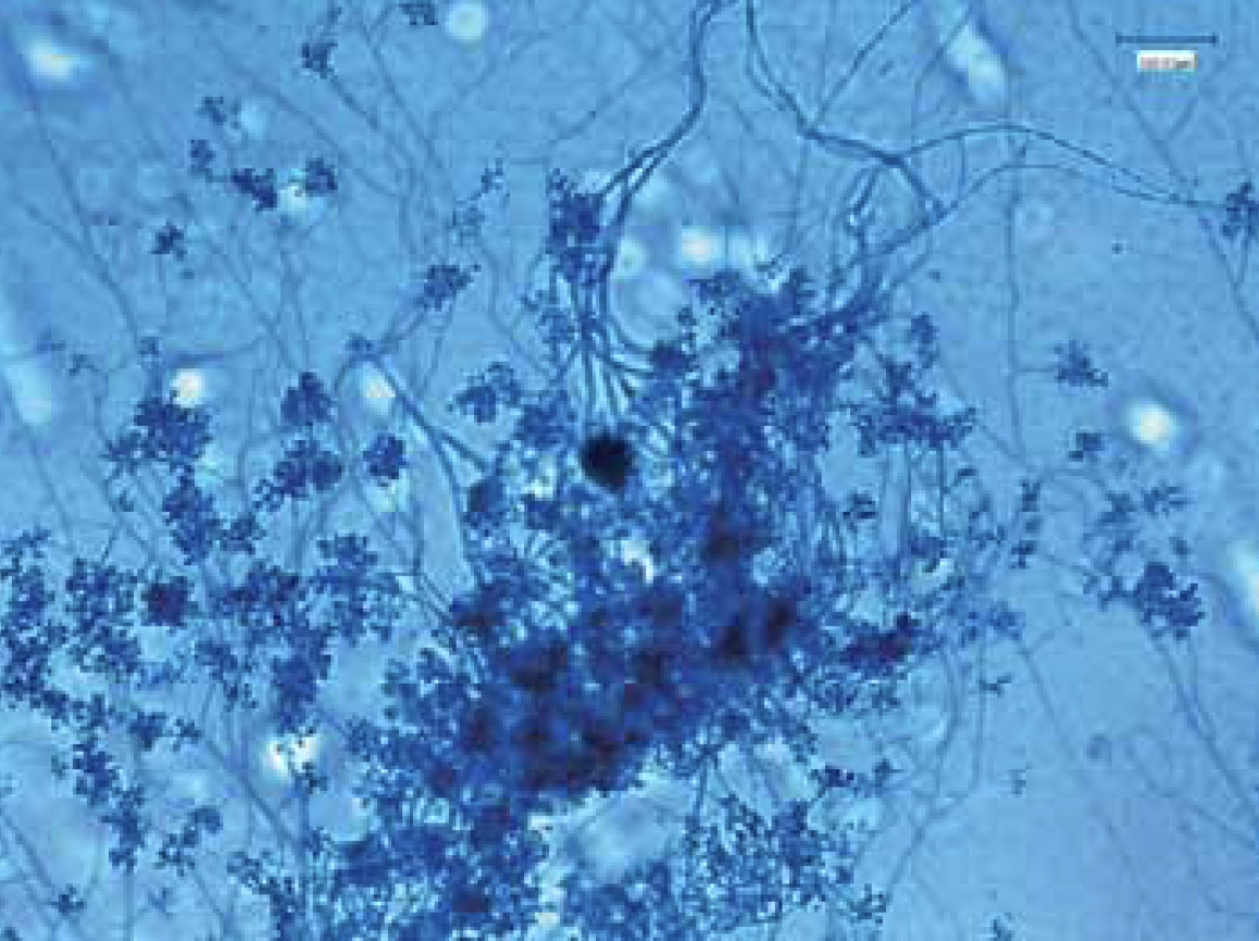 Trichoderma 1 Trichoderma 1