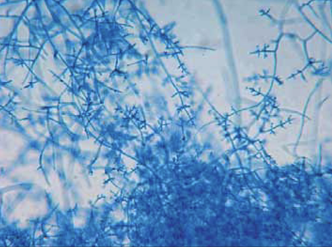 Trichoderma 2 Trichoderma 2